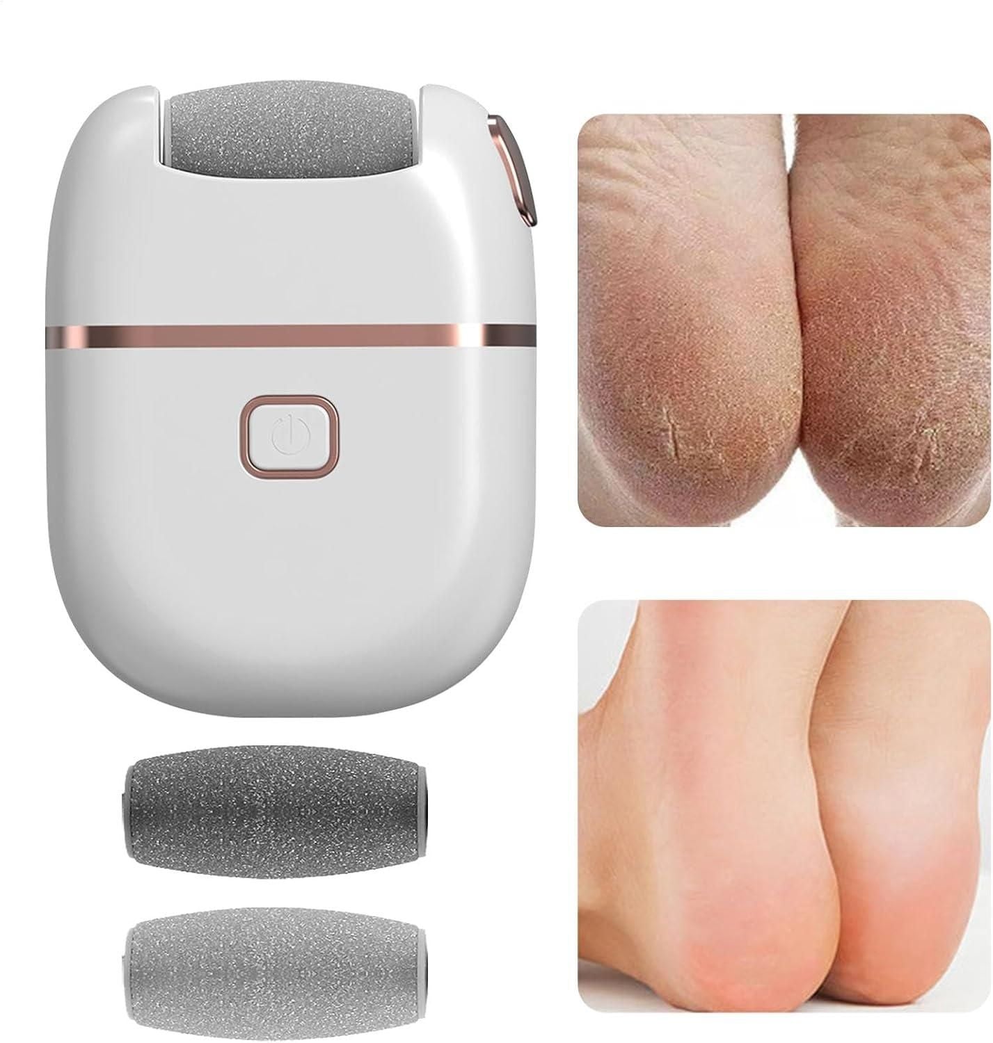 Electronic Pedicure Tool : DRC