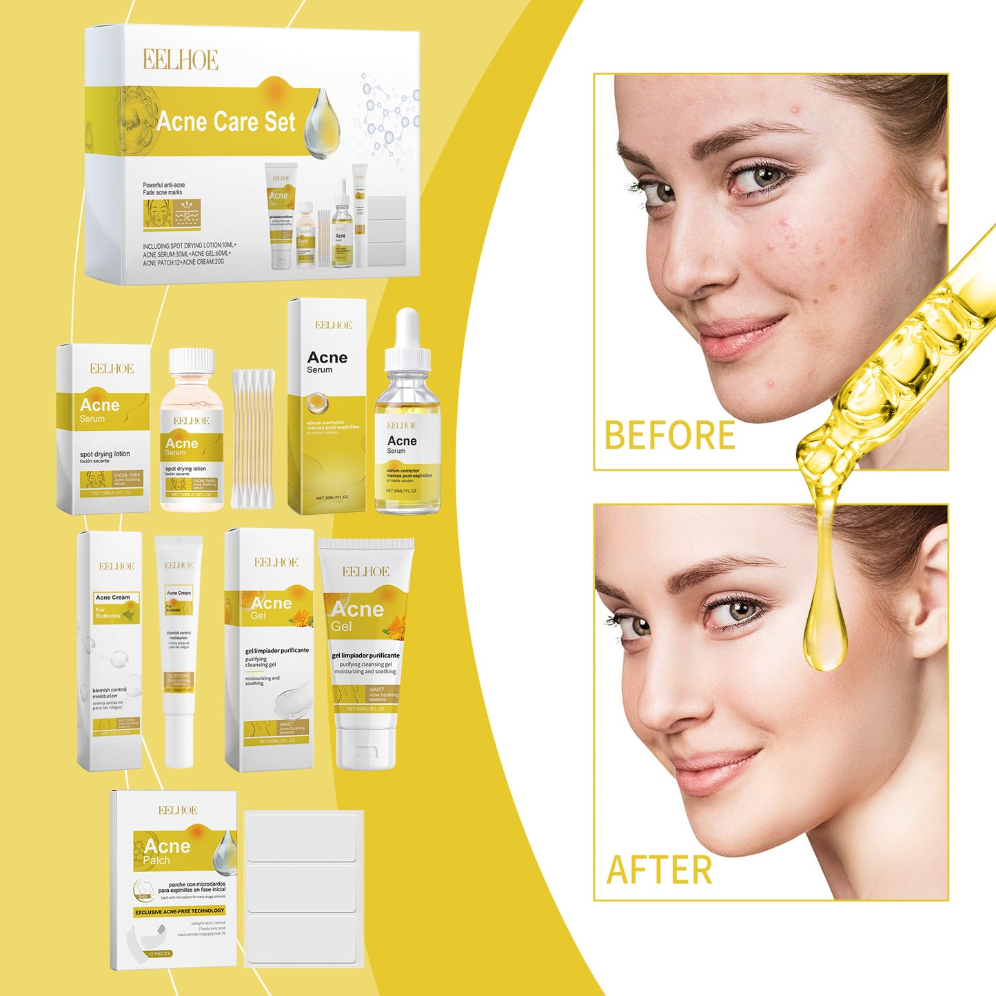 Acne Skin Care Set Skin Care For Acne Skin Is Suitable For Moisturizing And Beautify Soft Skin