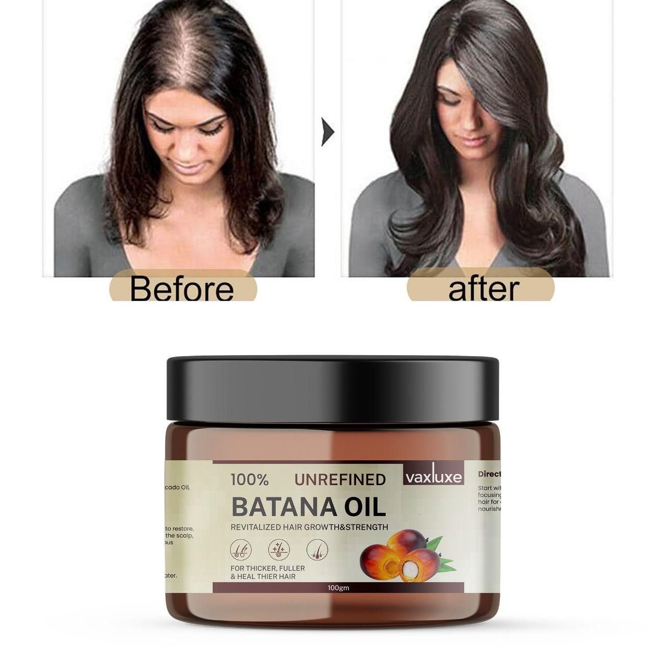 Vaxluxe Batana Oil - Revitalized Hair Growth & Strength 100g (Pack Of 1) : DRC