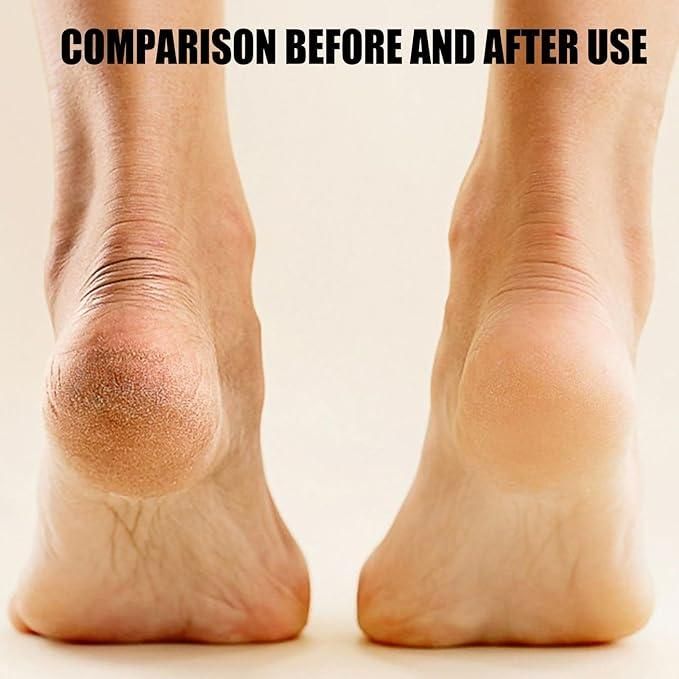 Electronic Pedicure Tool : DRC