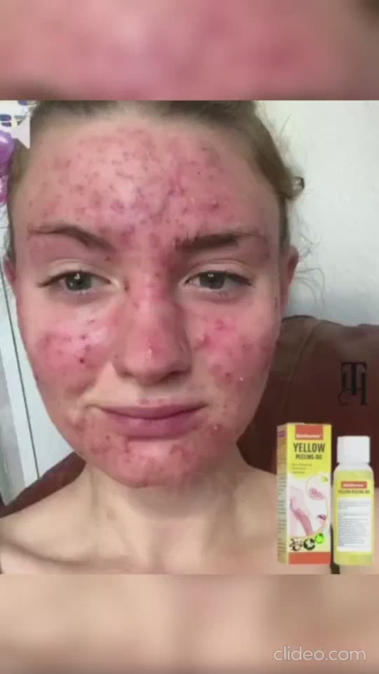 Peeling Oil for Dark Skin (Pack of 2) - 50 ml : DRC